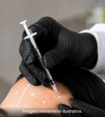 Aplicação de botox na região frontal