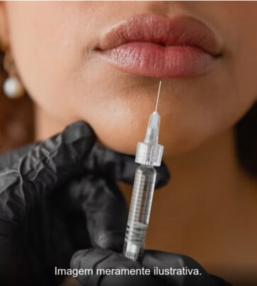 Aplicação de preenchimento labial
