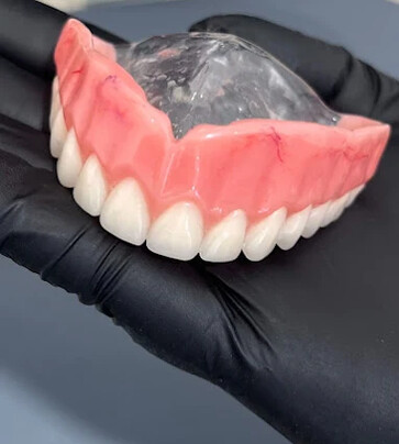 Prótese dentária removível